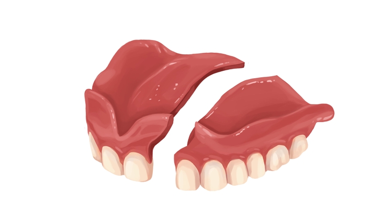 Same-day denture repair services near you